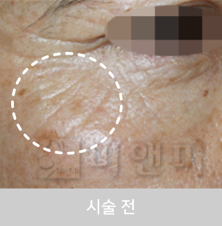 before_Img