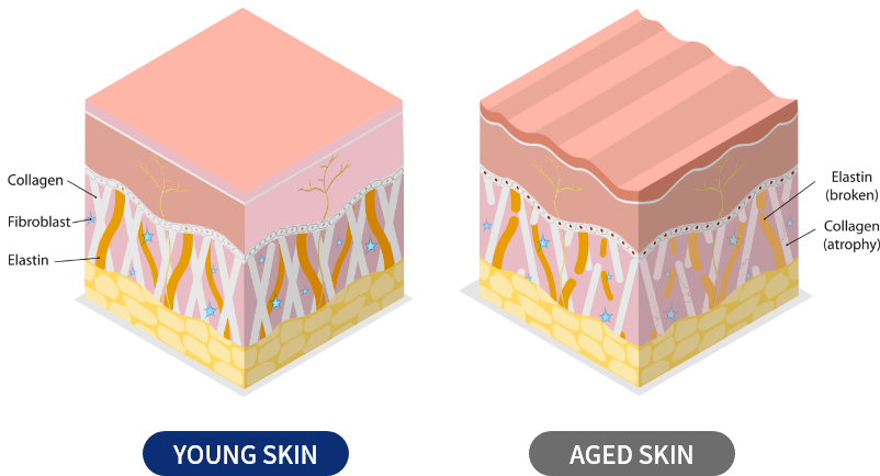 엘라비에 리투오